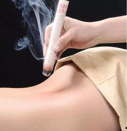 热敏灸视频,传统养生新体验